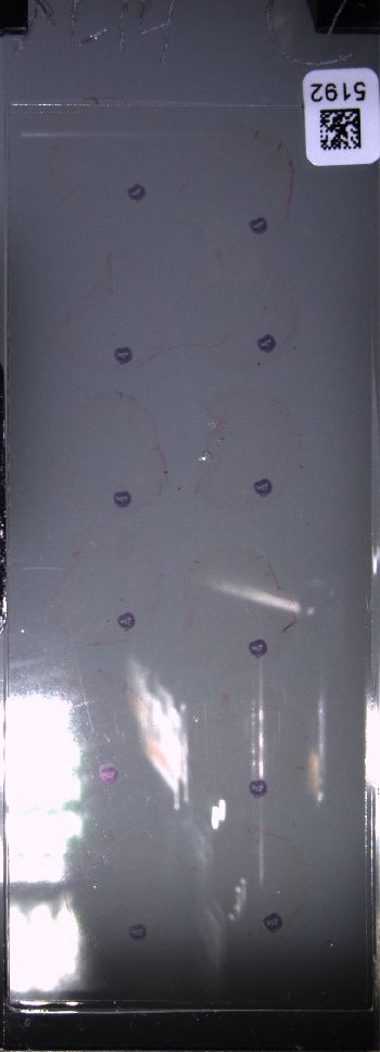 Media type: image; Special Collections 4011   shows specimen_part histological serial section;